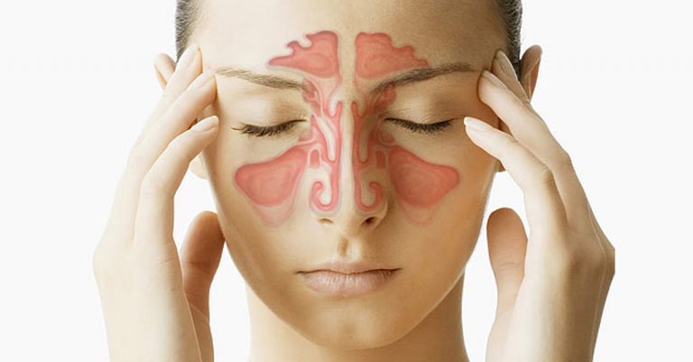 did-you-know-that-inflammation-of-the-sinuses-can-cause-eye-disease