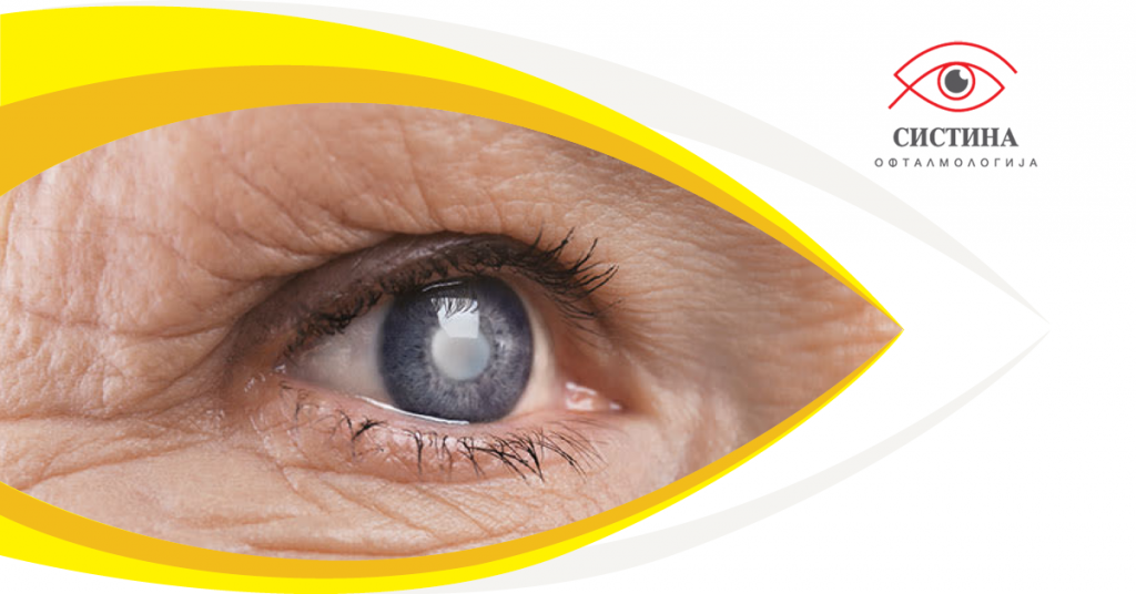 Cataract surgery, eye with cataract
